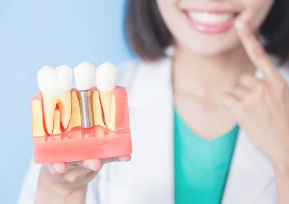 woman dentist take implant tooth Імплантація